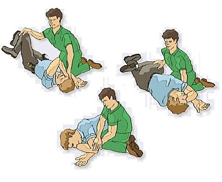 La Position Latérale de Sécurité(PLS)